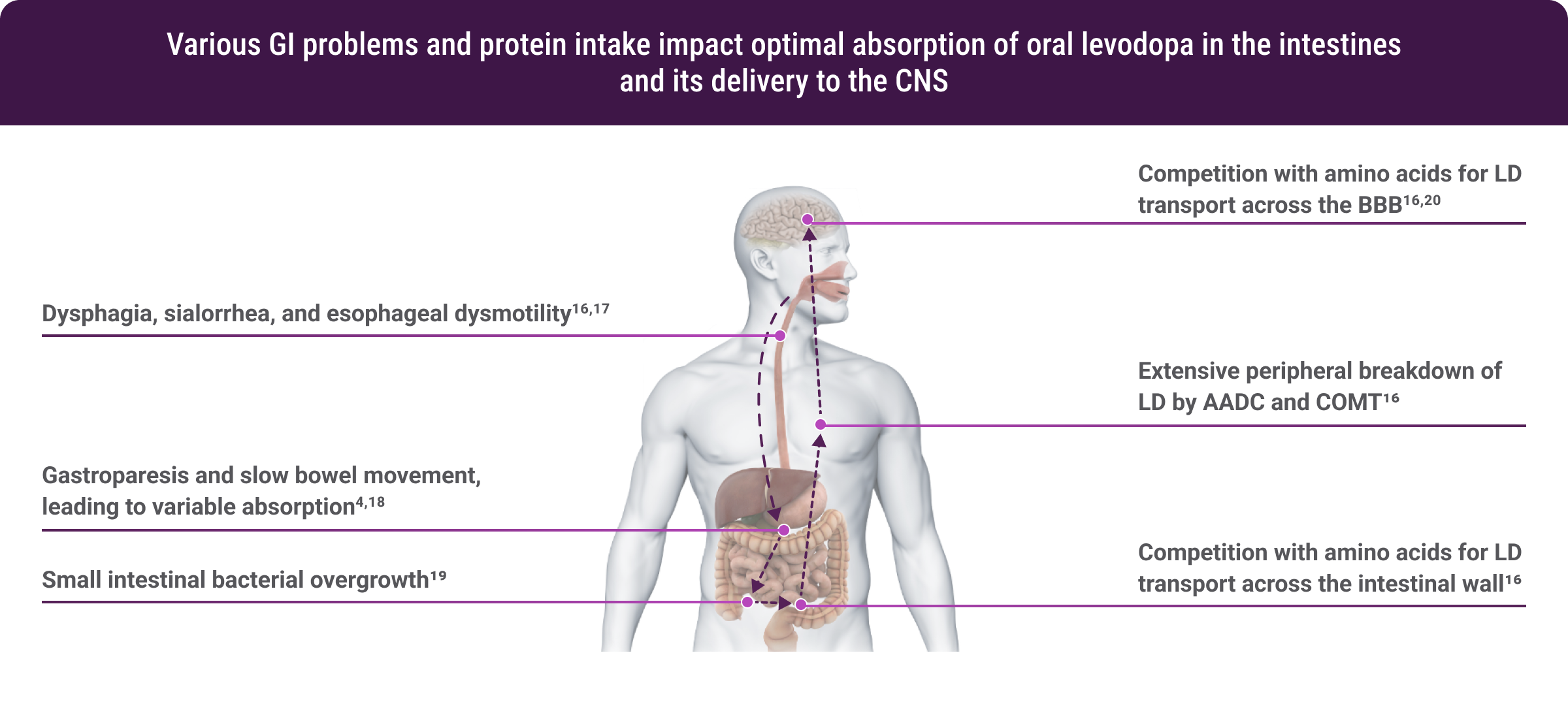 GI Problems Interior Graphic