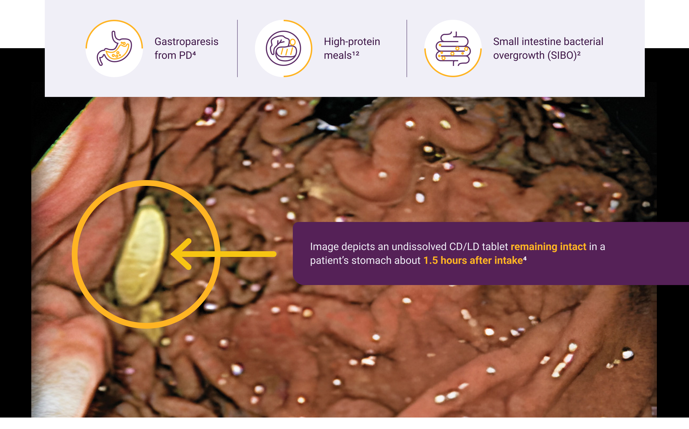 Why Inhaled Absorption Potential Factors Graphic